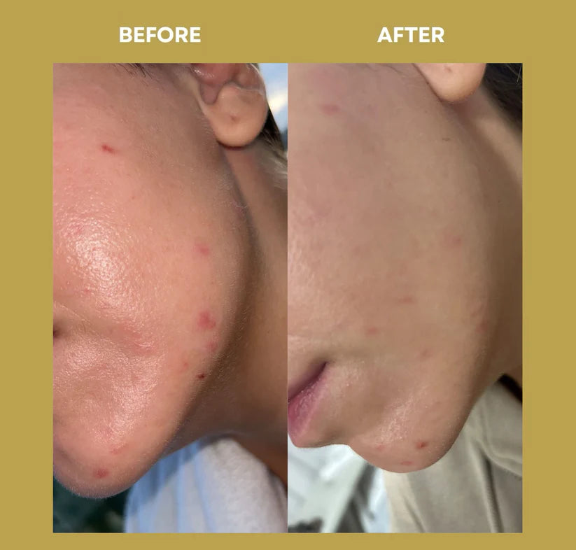 OCEAN ADVANCED REPAIR: Repair Cream | Anti-Imperfezioni