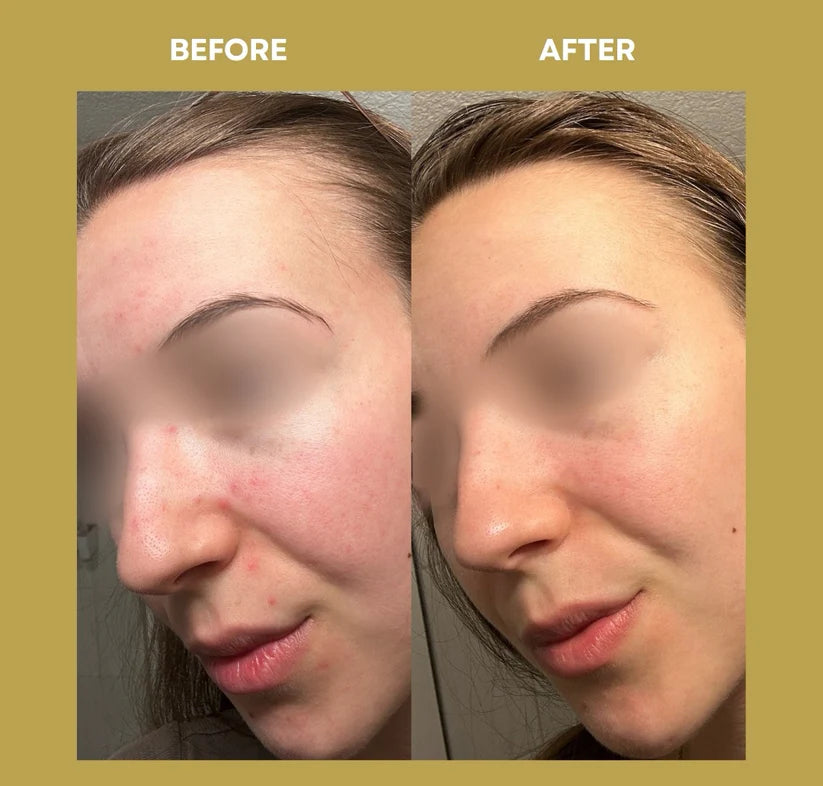 OCEAN ADVANCED REPAIR: Repair Cream | Anti-Imperfezioni